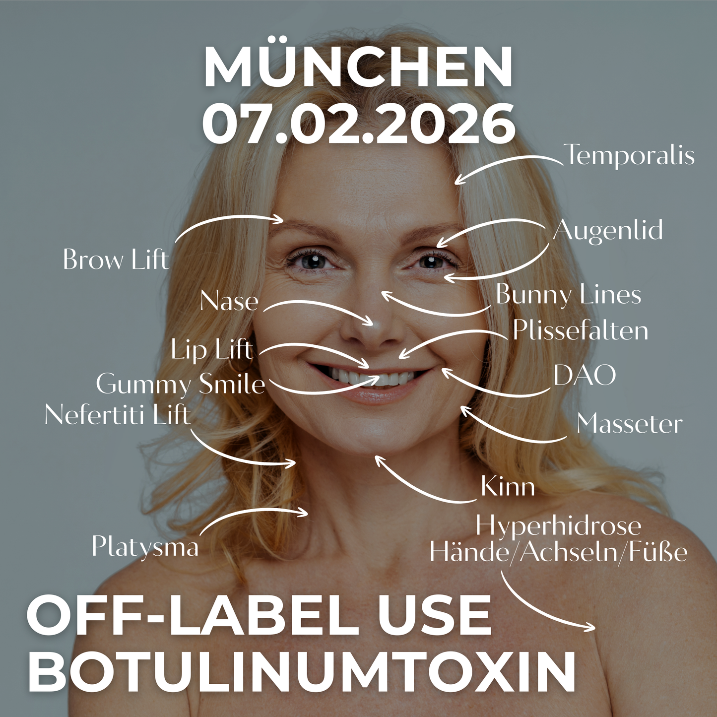 OFF-LABEL USE BOTULINUMTOXIN • 07.02.2026 • München