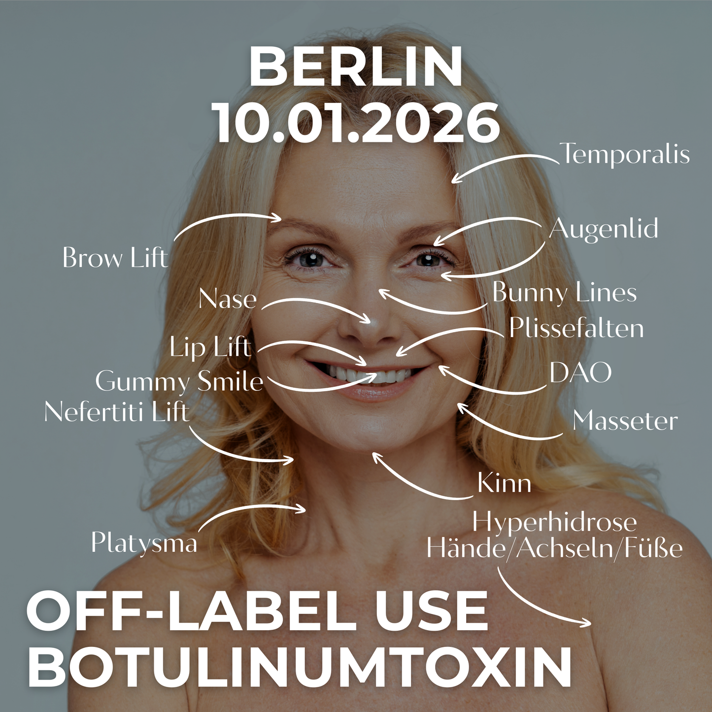 OFF-LABEL USE BOTULINUMTOXIN • 10.01.2026 • Berlin