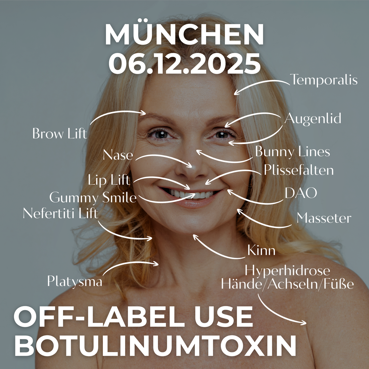 OFF-LABEL USE BOTULINUMTOXIN • 06.12.2025 • München